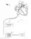 Fig. 02 - Enhanced activation onset time optimization by similarity based pattern matching