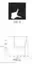 Fig. 05 - Automatic visual remote assessment of movement symptoms in people with parkinson's disease for MDS-UPDRS finger tapping task