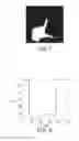 Fig. 06 - Automatic visual remote assessment of movement symptoms in people with parkinson's disease for MDS-UPDRS finger tapping task