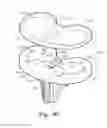 Fig. 25 - Prosthetic knee joint measurement system including energy harvesting and method therefor