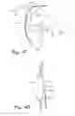 Fig. 30 - Prosthetic knee joint measurement system including energy harvesting and method therefor