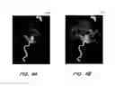 Fig. 05 - System and method for generating a time-encoded blood flow image from an arbitrary projection