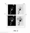Fig. 07 - System and method for generating a time-encoded blood flow image from an arbitrary projection