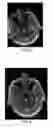 Fig. 04 - SYSTEMS AND METHODS FOR OPTIMIZED IMAGE ACQUISITION WITH IMAGE-GUIDED DECISION SUPPORT