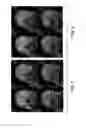 Fig. 05 - SYSTEMS AND METHODS FOR OPTIMIZED IMAGE ACQUISITION WITH IMAGE-GUIDED DECISION SUPPORT