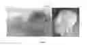 Fig. 06 - Thermoplastic 3-D phantom