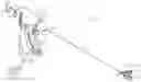 Fig. 01 - ENERGY-BASED LYMPH NODE DISSECTION DEVICE