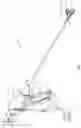 Fig. 02 - ENERGY-BASED LYMPH NODE DISSECTION DEVICE