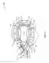 Fig. 11 - ENERGY-BASED LYMPH NODE DISSECTION DEVICE