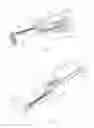 Fig. 03 - Actuator of medical device