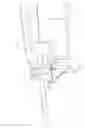 Fig. 07 - Biopsy device with automatic biopsy parameter adjustment