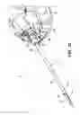 Fig. 56 - Biopsy device with automatic biopsy parameter adjustment