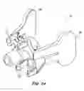 Fig. 64 - Biopsy device with automatic biopsy parameter adjustment
