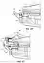 Fig. 66 - Biopsy device with automatic biopsy parameter adjustment