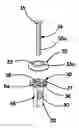 Fig. 01 - Implant devices and systems for stabilized fixation of bone and soft tissue