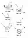 Fig. 04 - Implant devices and systems for stabilized fixation of bone and soft tissue