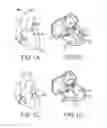 Fig. 02 - Cardiac implant migration inhibiting systems