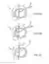 Fig. 06 - Cardiac implant migration inhibiting systems