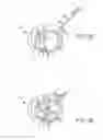 Fig. 07 - Cardiac implant migration inhibiting systems