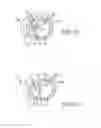 Fig. 08 - Cardiac implant migration inhibiting systems