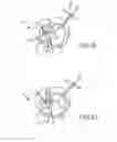 Fig. 10 - Cardiac implant migration inhibiting systems
