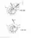 Fig. 12 - Cardiac implant migration inhibiting systems
