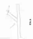 Fig. 08 - Methods and devices for tissue suturing