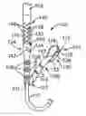 Fig. 01 - Apparatus and method for manipulating stomach tissue and treating gastroesophageal reflux disease