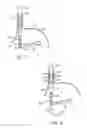 Fig. 05 - Apparatus and method for manipulating stomach tissue and treating gastroesophageal reflux disease