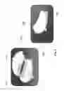 Fig. 03 - Suture Needle Capture Devices and Methods