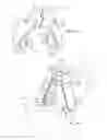 Fig. 04 - Surgical device