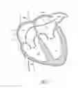 Fig. 10 - LEFT ATRIAL APPENDAGE OCCLUSION DEVICES AND METHODS