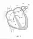 Fig. 12 - LEFT ATRIAL APPENDAGE OCCLUSION DEVICES AND METHODS