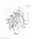 Fig. 04 - Orthopaedic surgical instrument assembly and method of manufacturing same