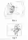 Fig. 07 - Orthopaedic surgical instrument assembly and method of manufacturing same