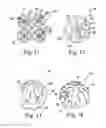 Fig. 09 - Orthopaedic surgical instrument assembly and method of manufacturing same