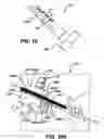 Fig. 12 - Universal surgical guide systems and methods
