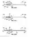Fig. 19 - Universal surgical guide systems and methods