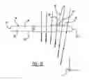 Fig. 09 - Adjustable glenoid pin insertion guide
