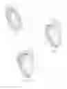 Fig. 02 - ANTHROSCOPIC JOINT REPAIR