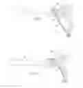Fig. 04 - ANTHROSCOPIC JOINT REPAIR