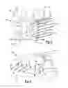 Fig. 03 - Tibial tubercule osteotomy