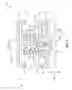 Fig. 04 - Femoral resection guide and method thereof