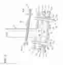 Fig. 07 - Method and apparatus for total knee arthroplasty