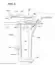 Fig. 08 - Method and apparatus for total knee arthroplasty