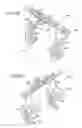 Fig. 16 - Method and apparatus for total knee arthroplasty