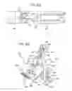 Fig. 19 - Method and apparatus for total knee arthroplasty