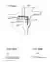 Fig. 26 - Method and apparatus for total knee arthroplasty