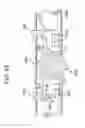 Fig. 34 - Method and apparatus for total knee arthroplasty