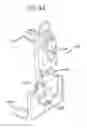 Fig. 35 - Method and apparatus for total knee arthroplasty
